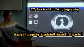 أساسيات الاشعة المقطعية وتصوير الأوعية | CT Basics And Angiography