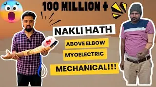 Above Elbow Prosthesis | Mechanical Elbow | Myoelectric Hand | Artificial Hand | Myoelectric Hand |