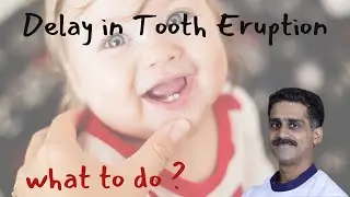 Milk teeth not erupting? a parent's guide