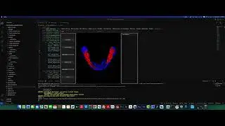 Teeth Segmentation Desktop Application