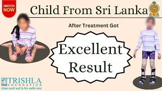 Sri Lankan Child with Cerebral Palsy Walks Independently | Miracle Recovery at Trishla Foundation