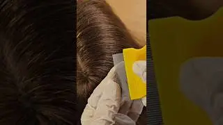 ASMR Lice found while brushing hair with metal comb
