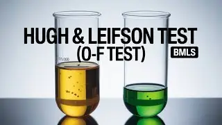 Hugh & Leifson Test (O/F Test) | Oxidative&ndash;Fermentative Test | Principle, Procedure & Result | BMLS