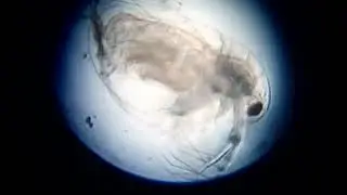 pathogenic micro organism in water