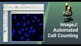 How to Measure Cell Count in ImageJ (Step-by-Step Tutorial)