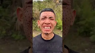 Survival Hack: Treat Acne in the Wild with Bamboo Charcoal