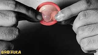 PREPARING FOR ANAL SEX TAKES TIME, BUT CAN PREVENT SERIOUS PROBLEMS