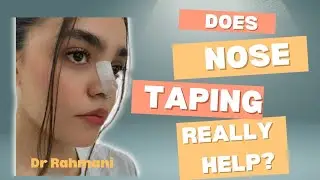 Does nose taping really help? What you should know after rhinoplasty.
