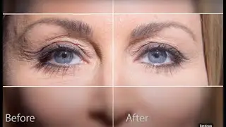 Jeunesse [ YES ] Youth Enhancement System - Beauty - Wellness - Anti Aging