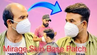Mirage Skin Base Patch | Hair Patches For Men | Full Natural Look Patches | 9599858612