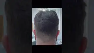Protesi Capillare Capelli Veri