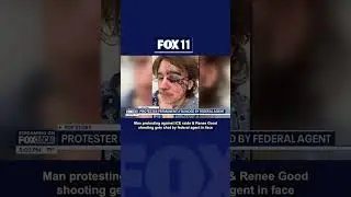 Man shot in face during Renee Good protest in Santa Ana | FOX 11 LA