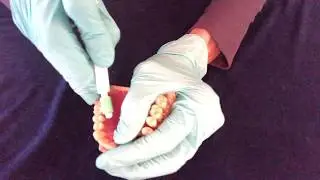 Toothpick techniques for dental and periodontal health