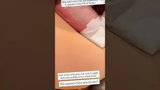 Kay & Tay Notice Baby Sutton&rsquo;s Rare Skin Change 😳 | Only 10% of Babies Get This! #KayandTay
