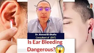 The Truth About Ear Bleeding and Blood Pressure REVEALED  | ProHealthConsults