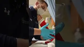 Как оптимизировать процесс отливки для короткой руки и почему мы используем стекловолокно