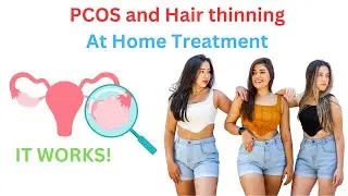 PCOS and Hair Loss: The Link and Treatment (At Home, but requires Effort)