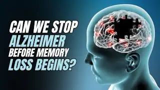 Can We Stop Alzheimer Before Memory Loss Begins? #science #brain #neuroscience #viralvideo #memories