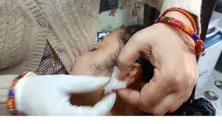 Chiraya kaan ka tintment #part 2