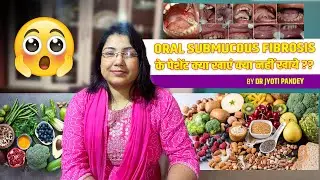 Oral SUBMUCOUS fibrosis के पेशेंट क्या खाएं क्या नहीं खाये ??