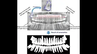 SIBGRAPI 2020 - A study on tooth segmentation and numbering using end to end deep neural networks