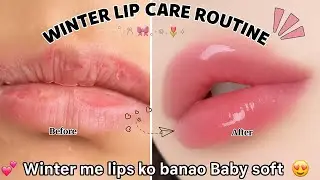 Say Goodbye to Dry & Chapped Lips ❄️ | Winter Lip Routine Step by Step| #winterlipcare#glamgirldiary