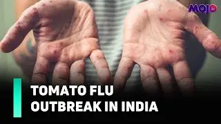 What Is Tomato Flu? | Why Has The Centre Issued An Advisory For It? | Explained