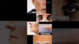 Dark patches removal #darkcircles #wrinkles #dryskin #darkpatches #lakshmihomeremedy #youtubeshorts