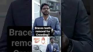 Braces teeth removal in 🅲🆁🅾🆆🅳🅸🅽🅶 #braces #teethcrowding
