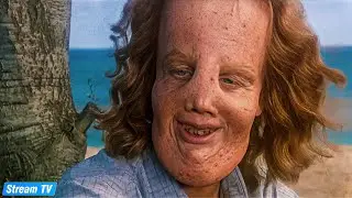 Based On A True Story - Meet Rocky Dennis
