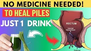 Nessuna medicina necessaria: basta un drink per curare le emorroidi
