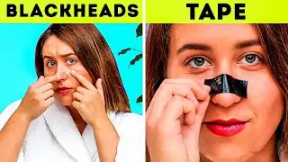 24 STICKY TAPE HACKS THAT WORTH MILLIONS || Awesome Tricks You Should Know