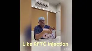 Trigeminal Neuralgia,,RFTC Treatment,,