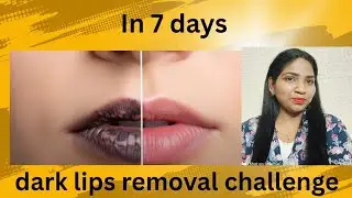 In 7 day Dark lips removal challenge | Remove Lip pigmentation | DIY for Dark lips | natural remedie