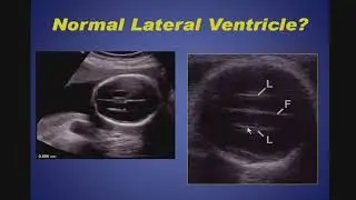 Borderlands in Obstetrical Ultrasound