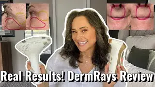 Transform Your Skin at Home! DermRays Revive & V8S Review