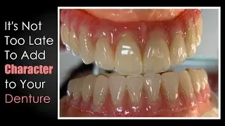 You Can Still Add Characteristics to Your Denture If You Aren't Satisfied After Processing