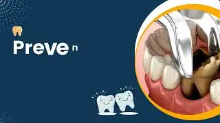 Fluoride Therapy: What is it?