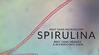 Reef Tank Microscopy - Spirulina