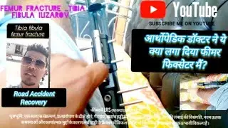Recovering Frm Fracture Bone Injury|| फ्रैक्चर बोन इंजरी से उबरना: युक्तियाँ और सलाह#leg cast