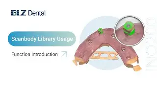 Intraoral Scanner Using Guide For Scanbody Library