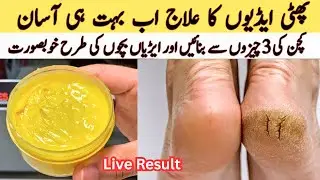 Remove Cracked Heels At Home |Home Remedies Hands feet repair cream | Hand whitening | Cracked Heels