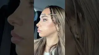 Skin before vs after makeup #makeup #skincare #acne #girls #relatable