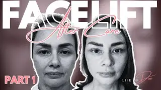 Ang Facelift Journey ni Donita Rose | Life of Dee Ep. 3