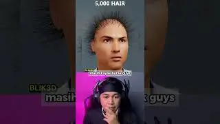 Inilah Ronaldo Versi Botak Sampai 500 Ribu Rambut 😱 #shorts