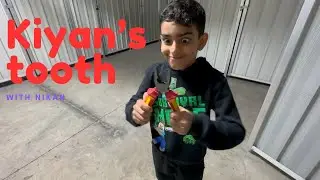 Kiyan's Tooth (skit)