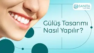 Gülüş Tasarımı Nasıl Yapılır?