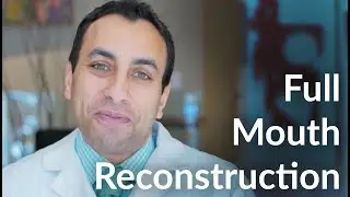 Full Mouth Reconstruction  - Dr. Tamer Azim, DDS - San Francisco Dentist