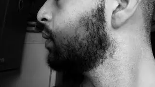 Growing Beard Using |MINXODIL | 1 Year and 8 Months results / @sobhiashrafi
