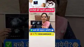 First sonography of pregnancy | Baby heartbeat in pregnancy #shorts #Drgourirai